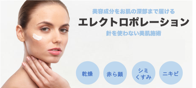 エレクトロポレーション